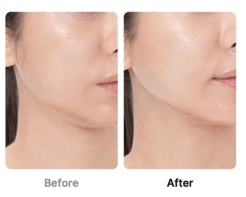 Medicube Age-R Booster Pro